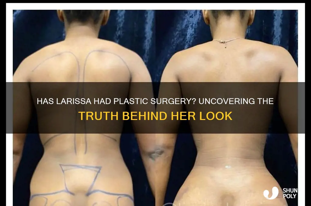 has larissa had plastic surgery