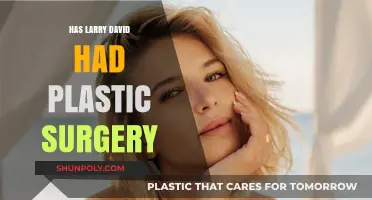 Larry David's Appearance: Plastic Surgery Rumors Explored and Debunked