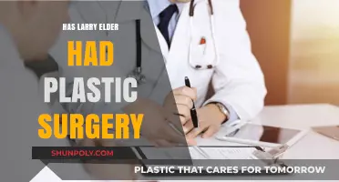 Has Larry Elder Undergone Plastic Surgery? Uncovering the Truth