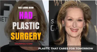 Laura Dern Plastic Surgery: Fact-Checking the Actress' Transformation Rumors