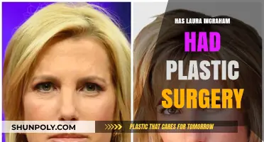 Laura Ingraham Plastic Surgery: Fact-Checking Rumors and Speculations