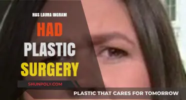 Laura Ingraham Plastic Surgery: Fact-Checking Rumors and Speculations