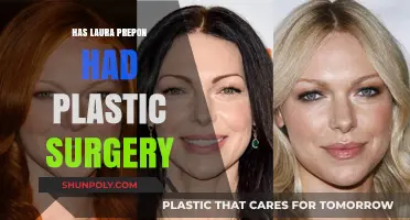 Laura Prepon's Transformation: Plastic Surgery Rumors Explored and Debunked