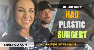 Lauren Boebert Plastic Surgery: Fact-Checking Rumors and Speculations