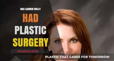 Lauren Holly Plastic Surgery: Fact-Checking Rumors and Speculations