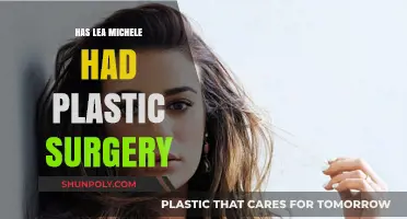 Lea Michele's Transformation: Plastic Surgery Rumors Explored
