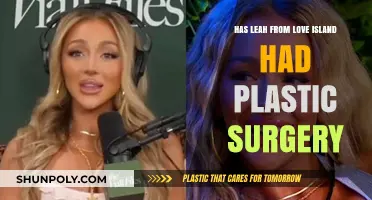 Leah Love Island Plastic Surgery: Fact-Checking the Transformation Rumors