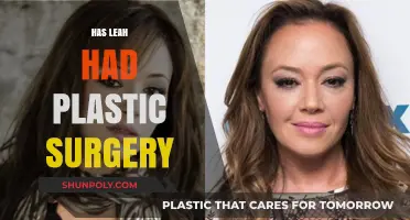 Leah's Transformation: Plastic Surgery Speculations and Truths Revealed