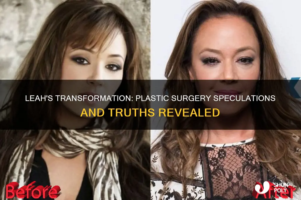 has leah had plastic surgery
