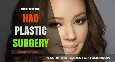 Leah Remini Plastic Surgery: Fact-Checking Her Transformation Rumors