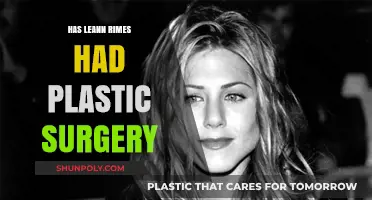 LeAnn Rimes Plastic Surgery: Fact-Checking Her Transformation Rumors