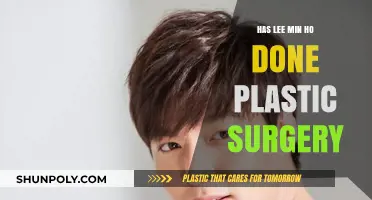 Lee Min Ho Plastic Surgery: Fact or Fiction?