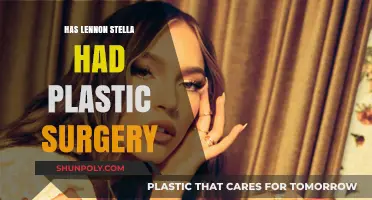 Has Lennon Stella Had Plastic Surgery? Unveiling the Truth