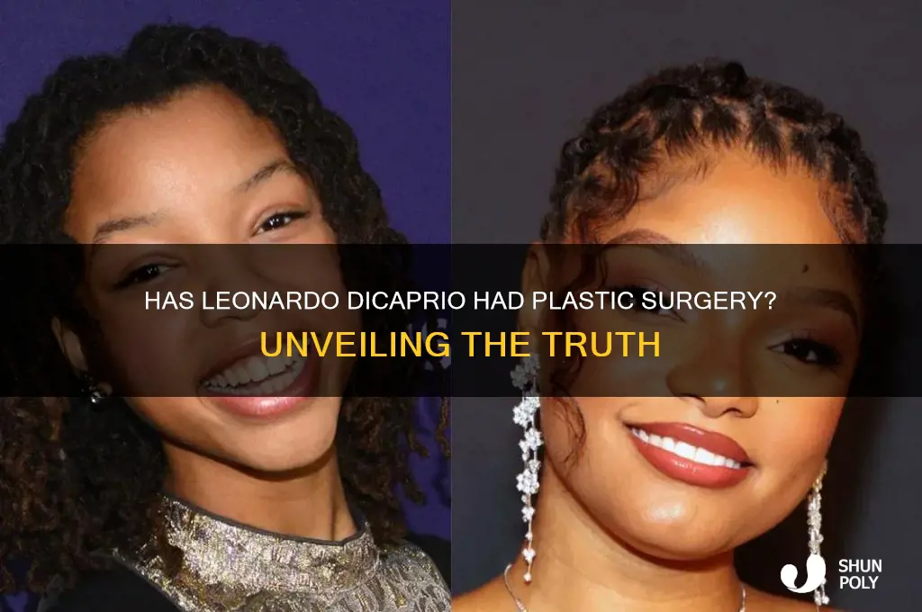 has leonardo dicaprio had plastic surgery