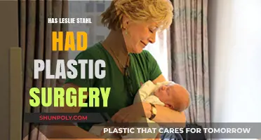 Leslie Stahl's Appearance: Plastic Surgery Speculations and Truths Revealed
