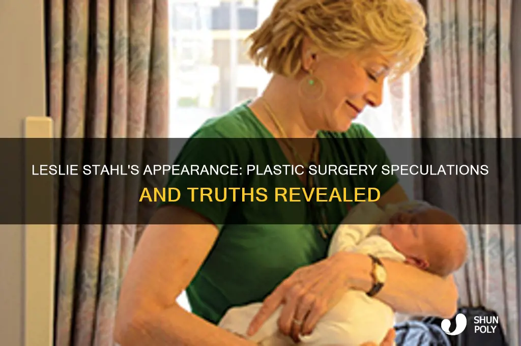 has leslie stahl had plastic surgery