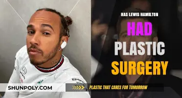 Has Lewis Hamilton Had Plastic Surgery? Unveiling the Truth