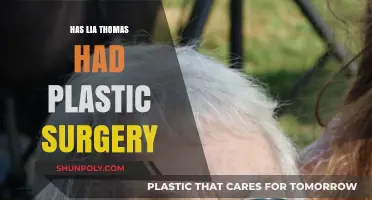 Lia Thomas Plastic Surgery: Fact-Checking the Rumors and Speculations