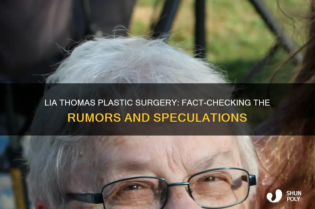has lia thomas had plastic surgery
