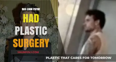 Liam Payne's Transformation: Plastic Surgery Rumors Explored and Debunked