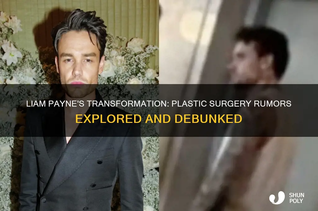 has liam payne had plastic surgery