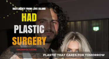 Liberty Love Island Plastic Surgery: Fact-Checking Her Transformation