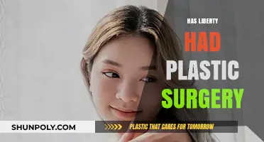 Has Liberty Undergone Plastic Surgery? Unveiling the Truth Behind the Rumors