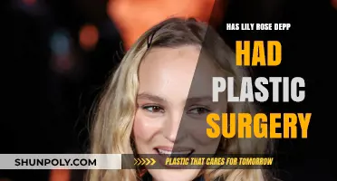 Lily-Rose Depp's Transformation: Natural Beauty or Plastic Surgery?