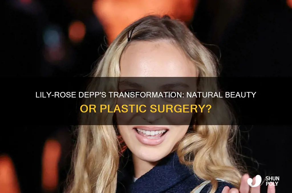 has lily rose depp had plastic surgery