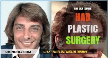 Has Lily Tomlin Had Plastic Surgery? Unveiling the Truth