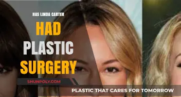 Has Linda Carter Had Plastic Surgery? Unveiling the Truth