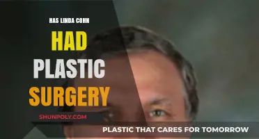 Linda Cohn's Appearance: Plastic Surgery Speculations and Facts Revealed
