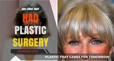 Linda Gray's Transformation: Plastic Surgery Speculations and Truths Revealed