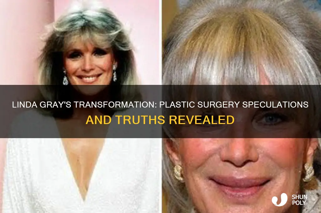 has linda gray had plastic surgery