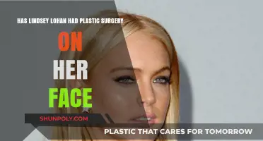 Lindsey Lohan's Face Transformation: Plastic Surgery Speculations Explored