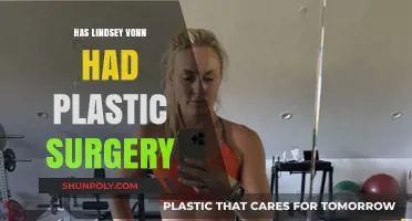 Lindsey Vonn Plastic Surgery: Fact-Checking Rumors and Speculations