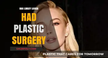 Lindsay Lohan's Transformation: Plastic Surgery Rumors and Speculations Explored