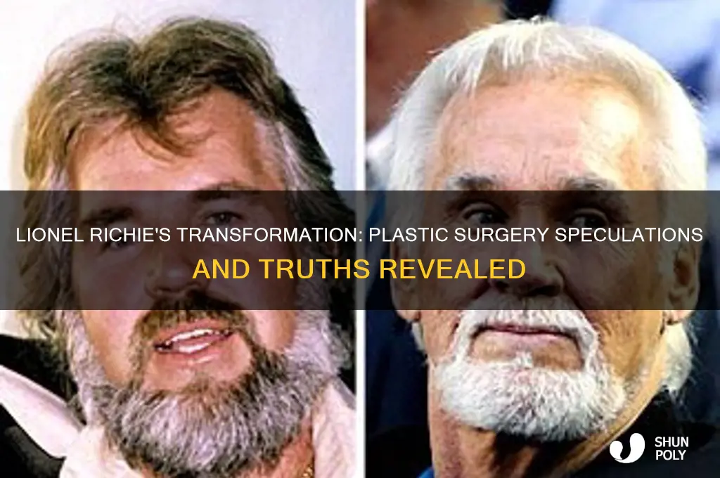 has lional richie had plastic surgery