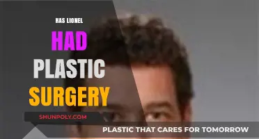 Lionel's Transformation: Plastic Surgery Rumors and the Truth Behind Them