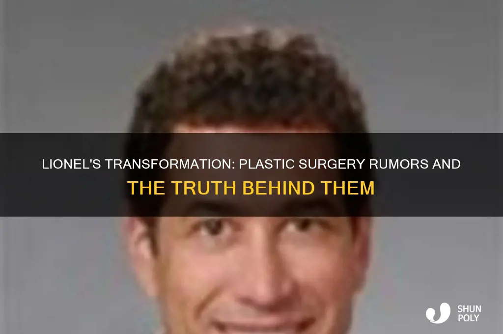 has lionel had plastic surgery