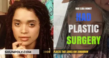 Lisa Bonet Plastic Surgery: Fact-Checking the Rumors and Speculations