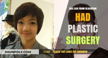 Lisa from BLACKPINK: Plastic Surgery Rumors and the Truth