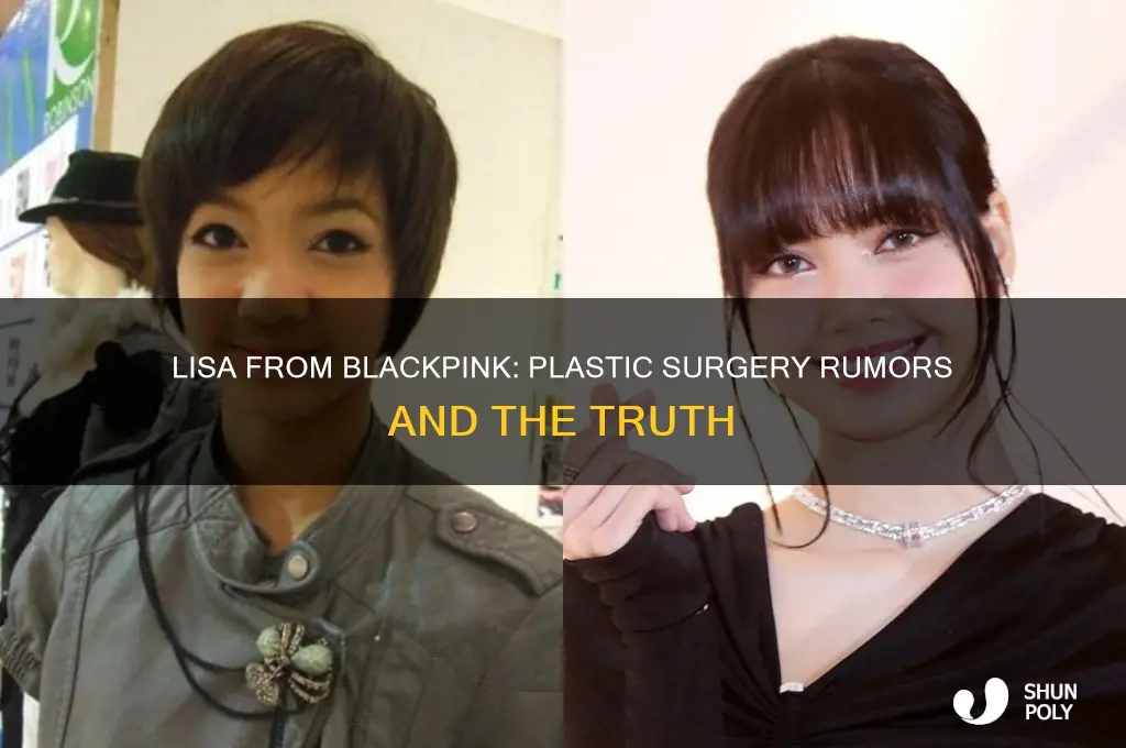 has lisa from blackpink had plastic surgery