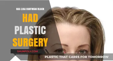 Lisa Hartman Black's Transformation: Plastic Surgery Speculations and Truths
