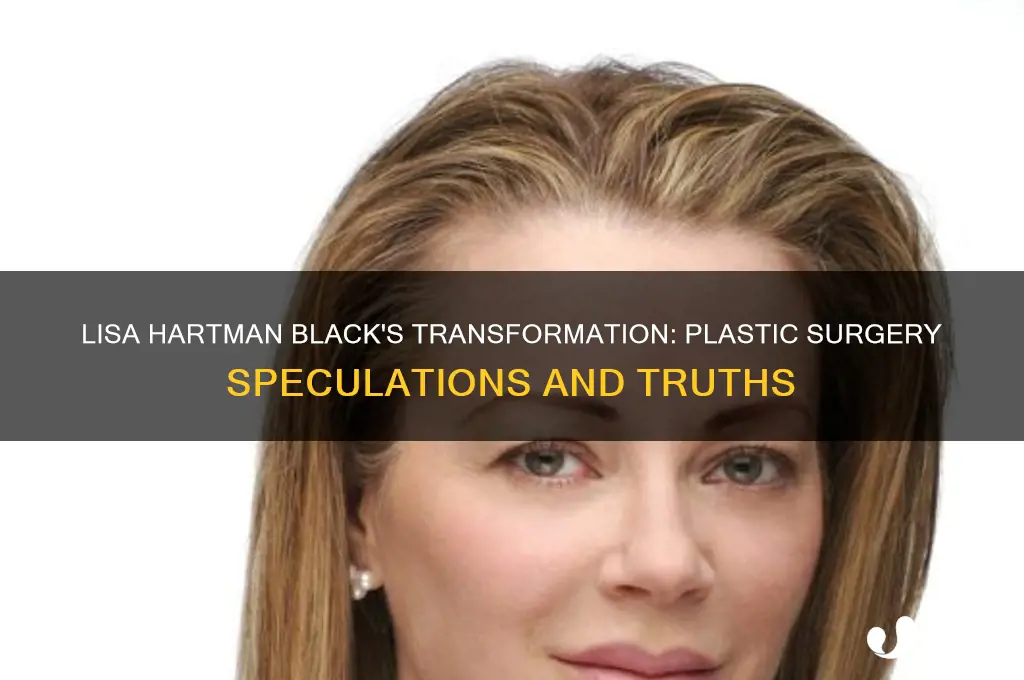 has lisa hartman black had plastic surgery