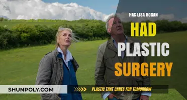 Lisa Hogan's Transformation: Plastic Surgery Speculations and Truths Revealed