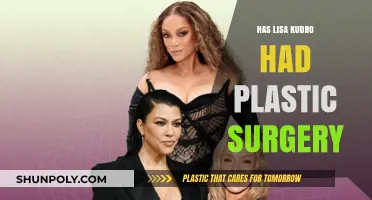 Lisa Kudrow's Appearance: Plastic Surgery Rumors Explored and Analyzed