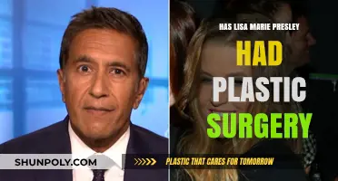Lisa Marie Presley's Transformation: Plastic Surgery Speculations and Truths
