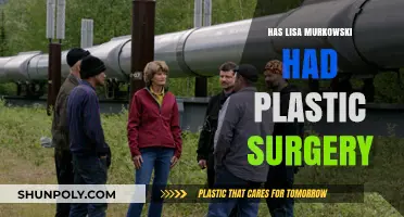 Lisa Murkowski Plastic Surgery: Fact-Checking the Rumors and Speculations