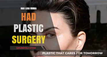Lisa Rinna's Transformation: Plastic Surgery Rumors and Reality Revealed